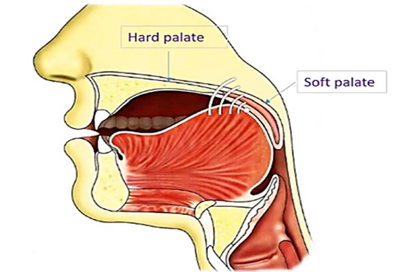 Tongue Placement Exercises